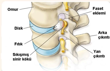 Sinir Damarları Sinir Damarı Zedelenmesi Tedavisi